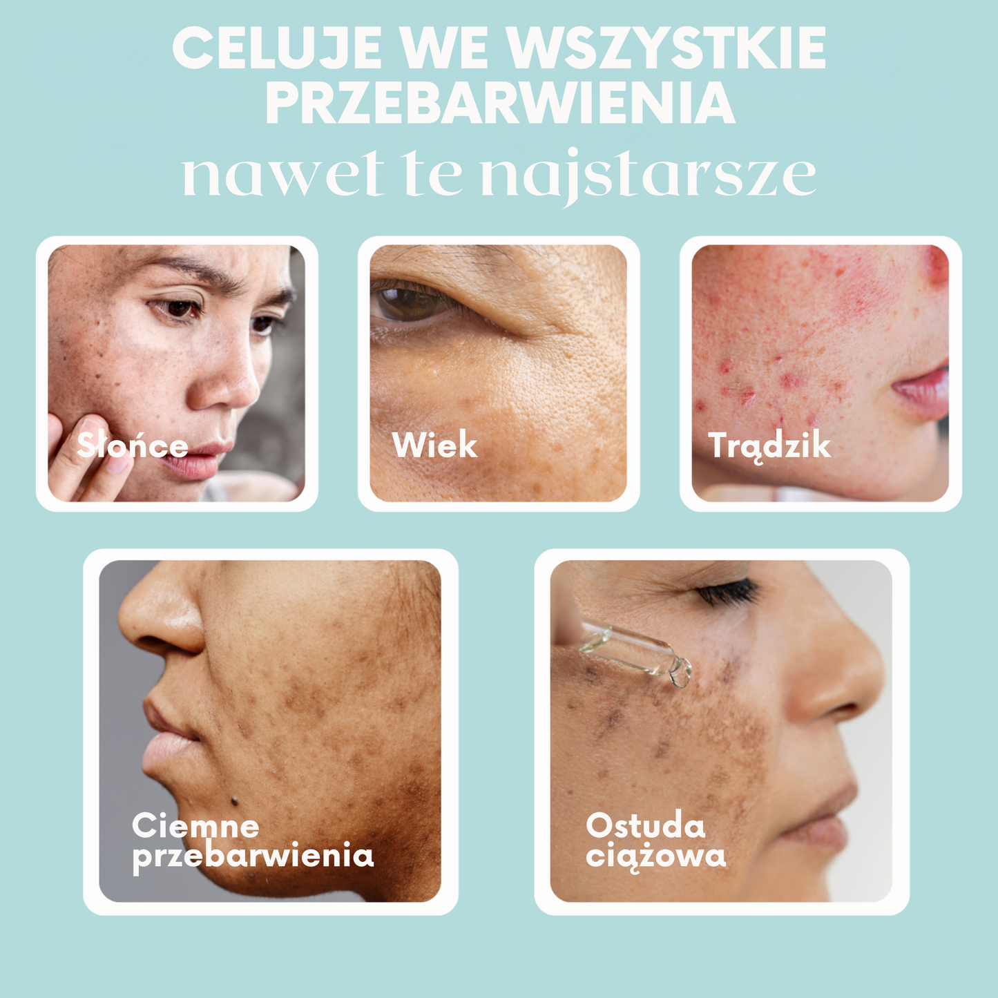 GlowSkin Pure® – Krem Przeciw Przebarwieniom