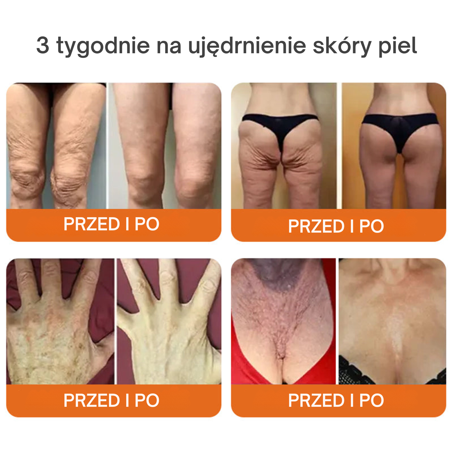 Krem z jadem pszczelim  Gładka i jędrna skóra w 7 dni