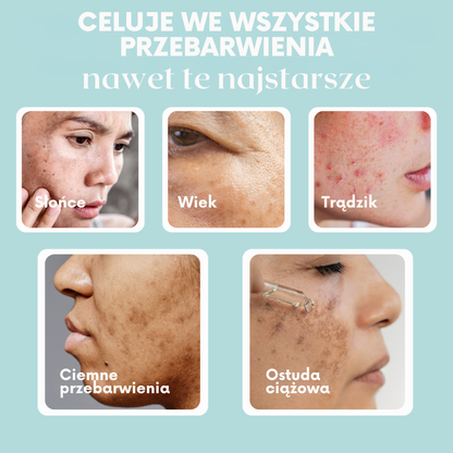 GlowSkin Pure® – Krem Przeciw Przebarwieniom